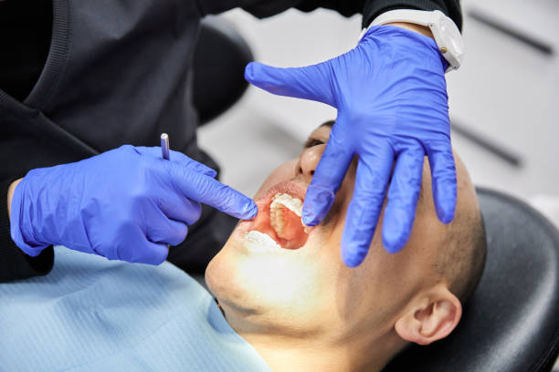 Best Emergency Dental Care for Broken or Chipped Teeth in Union Park, FL